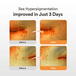 Serum pentru pete pigmentare cu glutathion, ABIB, 50ml - Imagine 3