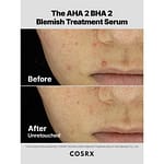 Tratament pentru imperfecțiuni, COSRX, The AHA 2 BHA 2 Blemish Treatment, 120g - Imagine 6
