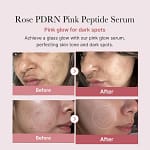 Ser pentru ten, PDRN Pink Peptide, medicube, 30ml - Imagine 4