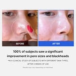 Dischete exfoliante pentru curățare profundă, Medicube, Zero Pad 2.0, 70 buc - Imagine 2